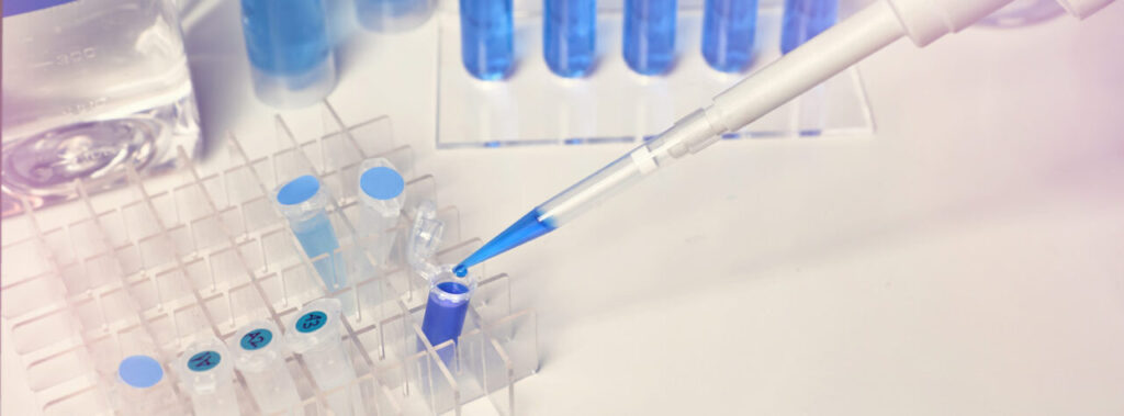 PSSM-Pferd-PCR-Test-Gen-Test
